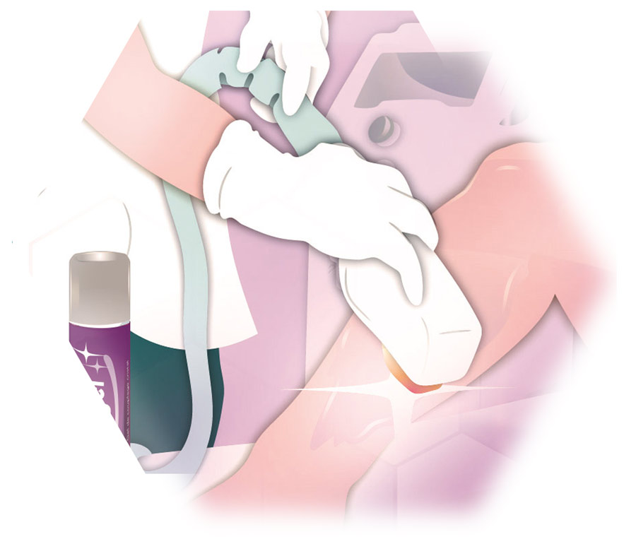 Illustration Treatment on the leg