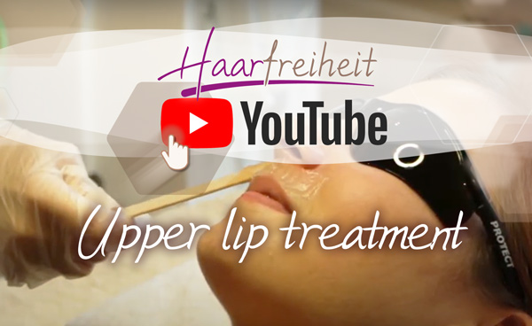 Upper Lip treatment