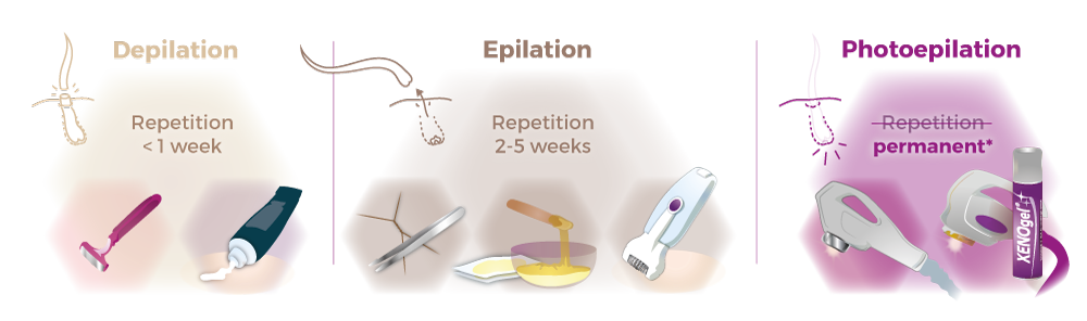Depilation and epilation in comparison