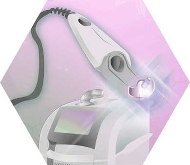 Illustration Alexandritlaser