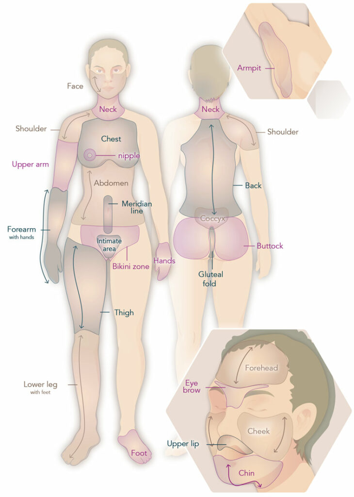 Infographic Woman body regions for photoepilation