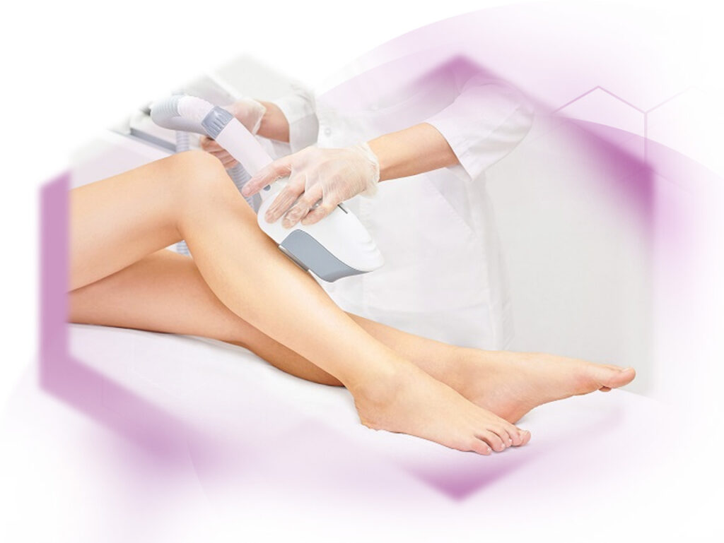 treatment with IPL