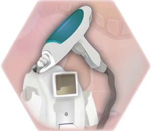 ND-YAG-Laser Grafik